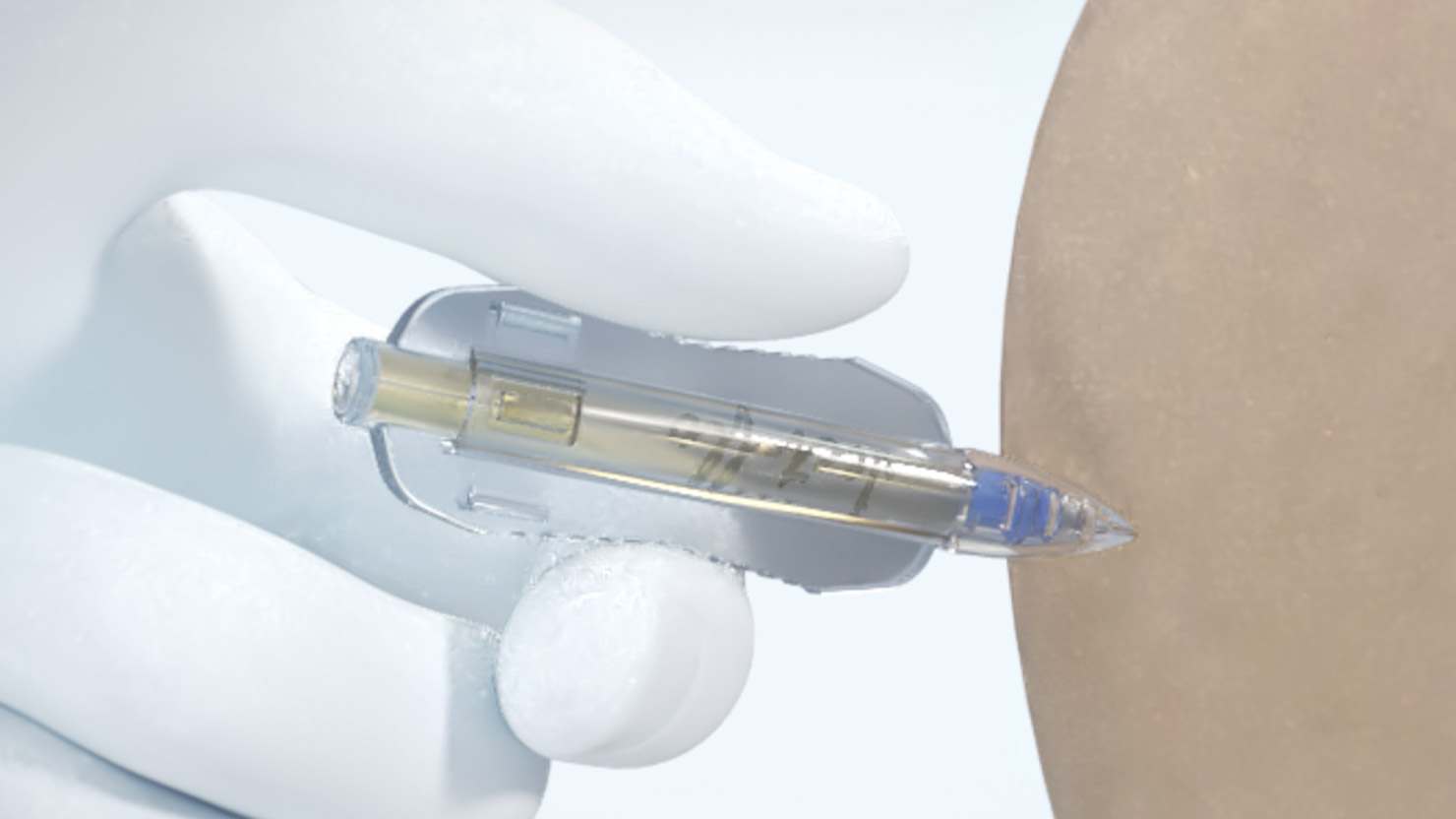 Global Prefilled Syringes Market projected to reach  USD 10.1 billion by 2027, growing at a CAGR of 9.8% from 2020 to 2027